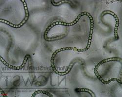 nostoc at 400x magnification