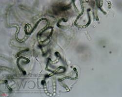 nostoc at 400x magnification photo two